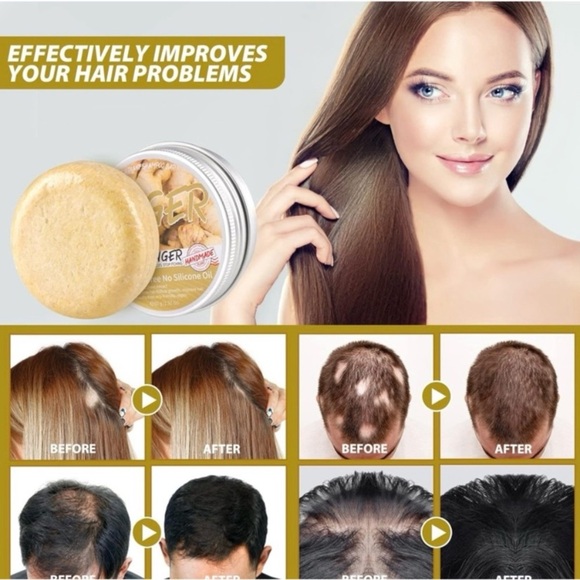 Ginger Hair Regrowth Shampoo 2 Bar Bundle Ginger Polygonum Shampoo Soap NEW NWT - Picture 2 of 12